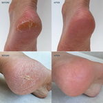 Load image into Gallery viewer, Solemate Heel Repair - Stick Balm Lavender