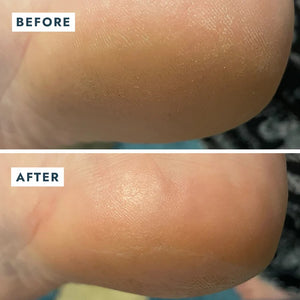 Solemate Heel Repair - Stick Balm