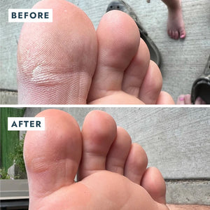 Solemate Heel Repair - Stick Balm